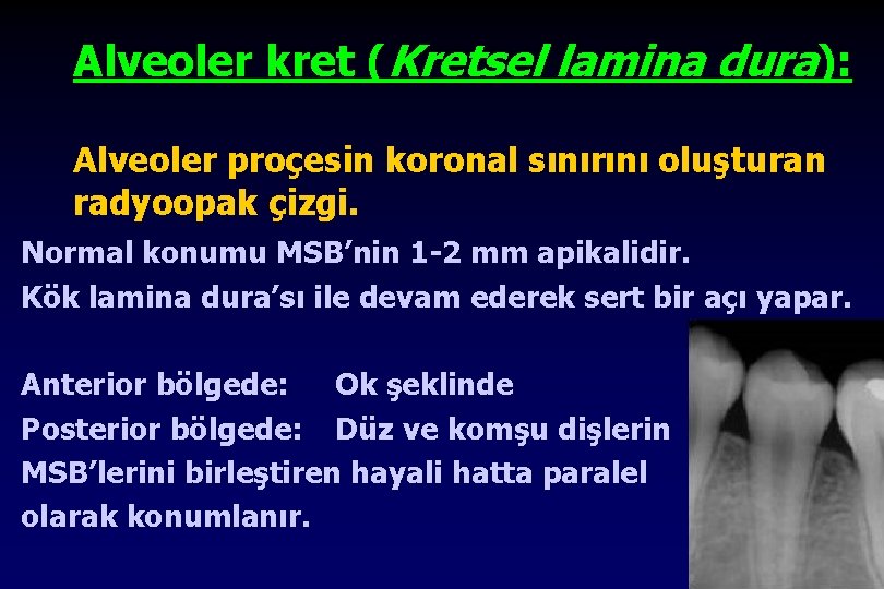 Alveoler kret (Kretsel lamina dura): Alveoler proçesin koronal sınırını oluşturan radyoopak çizgi. Normal konumu