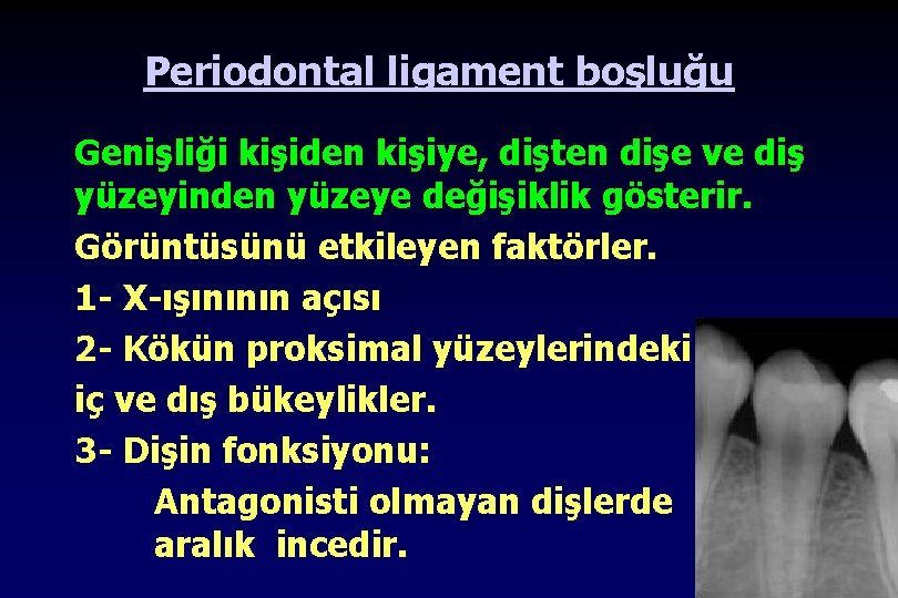 Periodontal ligament boşluğu Genişliği kişiden kişiye, dişten dişe ve diş yüzeyinden yüzeye değişiklik gösterir.