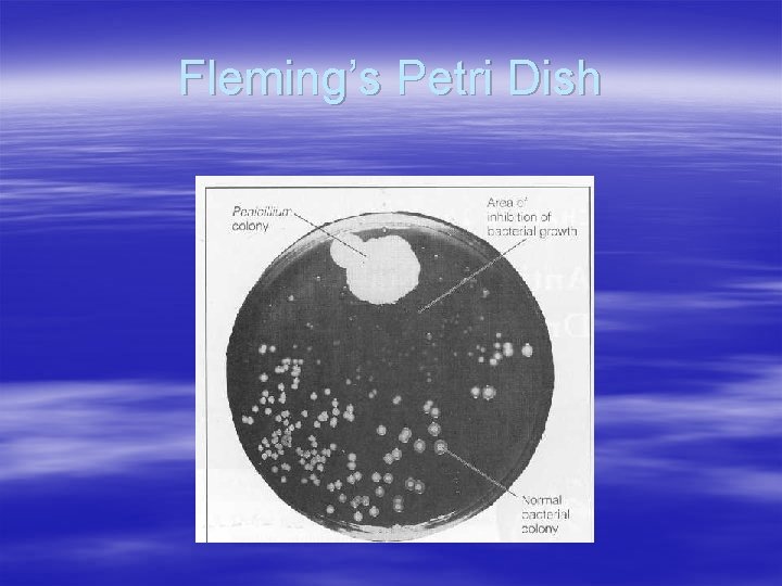 Fleming’s Petri Dish 