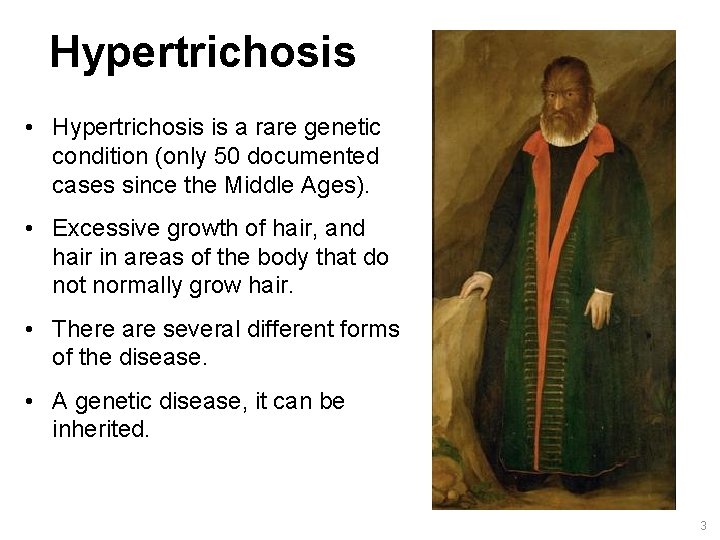 Hypertrichosis • Hypertrichosis is a rare genetic condition (only 50 documented cases since the