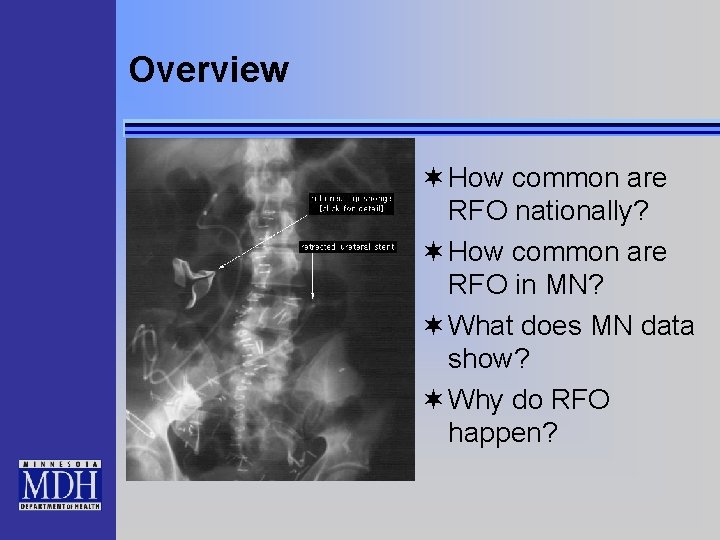 Overview ¬ How common are RFO nationally? ¬ How common are RFO in MN?