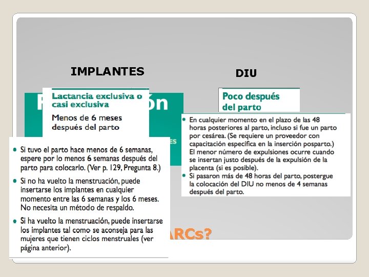 IMPLANTES ¿Cuándo iniciar LARCs? DIU 