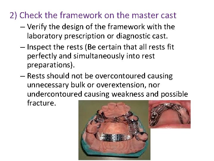 2) Check the framework on the master cast – Verify the design of the