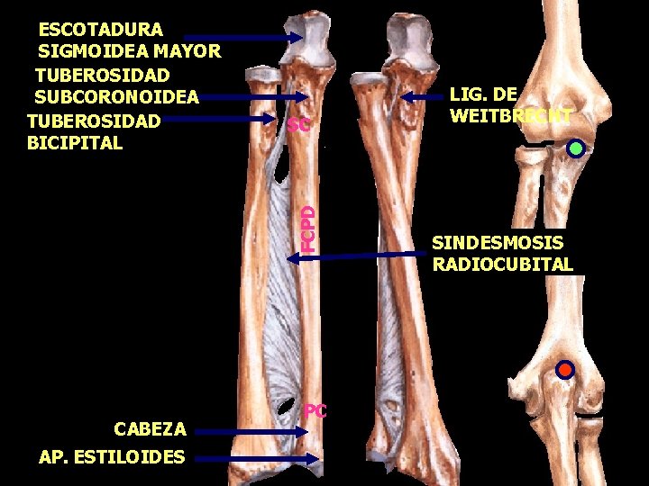 SC FCPD ESCOTADURA SIGMOIDEA MAYOR TUBEROSIDAD SUBCORONOIDEA TUBEROSIDAD BICIPITAL CABEZA AP. ESTILOIDES PC LIG.