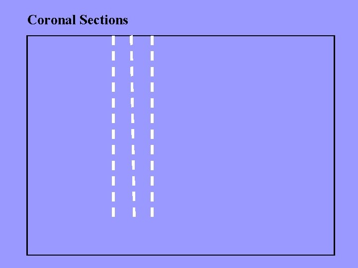 Coronal Sections 