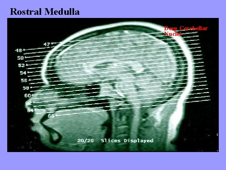 Rostral Medulla Deep Cerebellar Nuclei Goss 