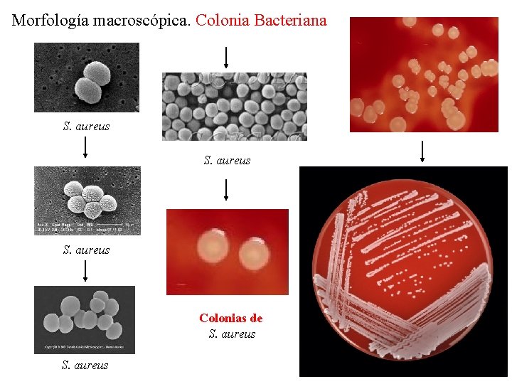 Morfología macroscópica. Colonia Bacteriana S. aureus Colonias de S. aureus 