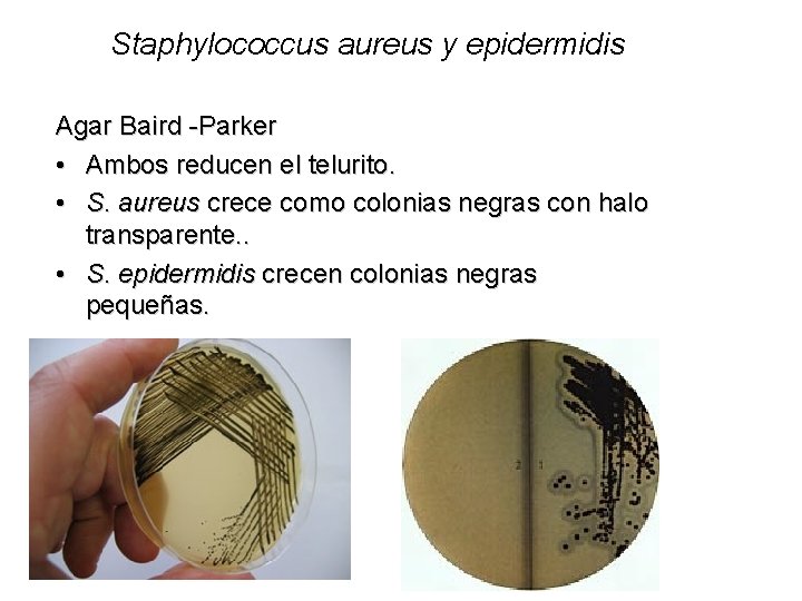 Staphylococcus aureus y epidermidis Agar Baird -Parker • Ambos reducen el telurito. • S.