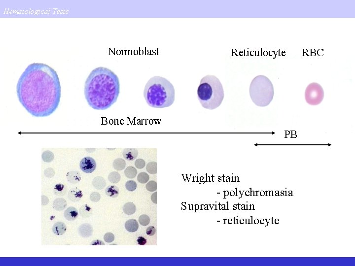 Hematological Tests Normoblast Reticulocyte Bone Marrow PB Wright stain - polychromasia Supravital stain -