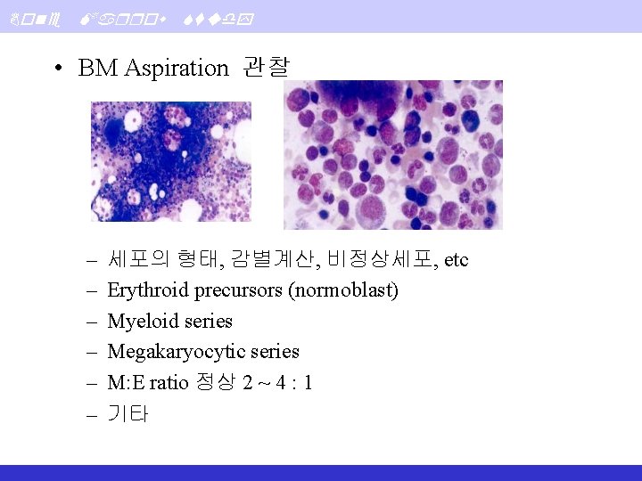 Bone Marrow Study • BM Aspiration 관찰 – – – 세포의 형태, 감별계산, 비정상세포,