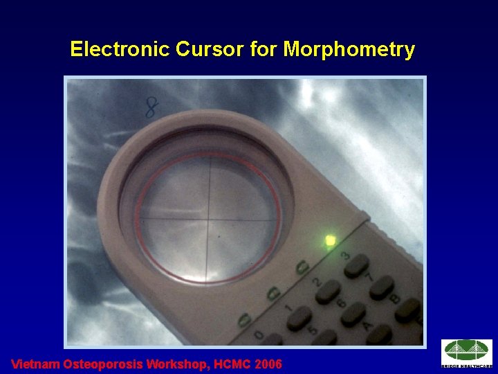 Electronic Cursor for Morphometry Vietnam Osteoporosis Workshop, HCMC 2006 