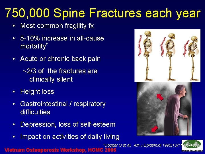 750, 000 Spine Fractures each year • Most common fragility fx • 5 -10%