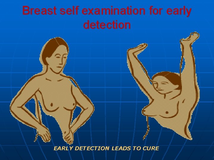 Breast self examination for early detection EARLY DETECTION LEADS TO CURE 