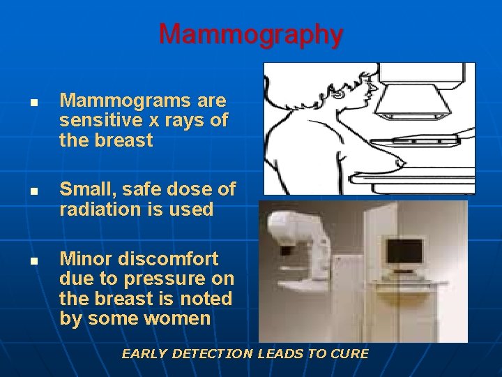 Mammography n n n Mammograms are sensitive x rays of the breast Small, safe