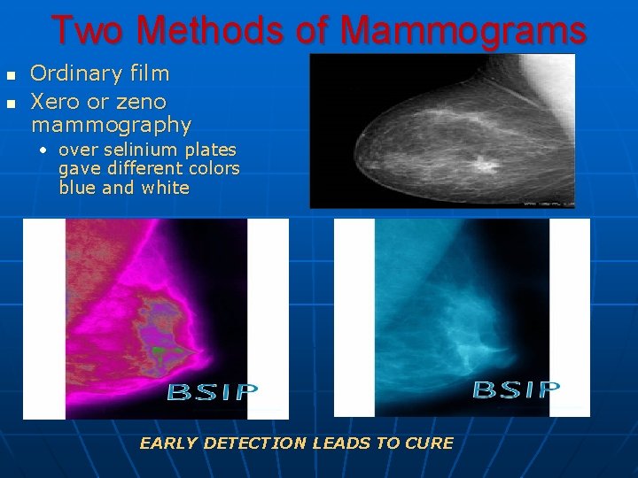 Two Methods of Mammograms n n Ordinary film Xero or zeno mammography • over