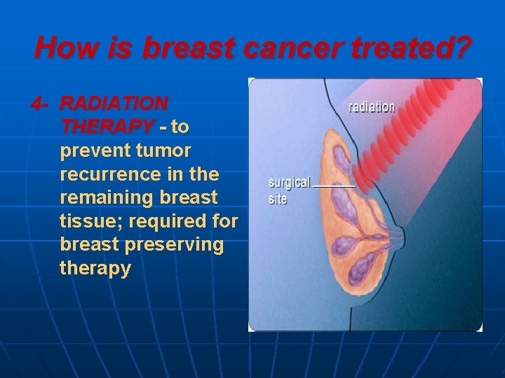 How is breast cancer treated? 4 - RADIATION THERAPY - to prevent tumor recurrence