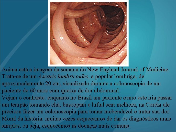 Acima está a imagem da semana do New England Journal of Medicine. Trata-se de