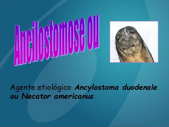 Agente etiológico: Ancylostoma duodenale ou Necator americanus 