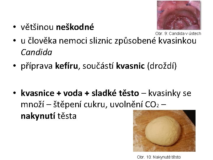  • většinou neškodné Obr. 9: Candida v ústech • u člověka nemoci sliznic