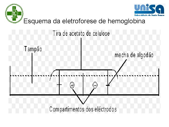 Esquema da eletroforese de hemoglobina 