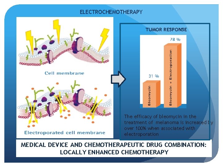 ELECTROCHEMOTHERAPY TUMOR RESPONSE The efficacy of bleomycin in the treatment of melanoma is increased