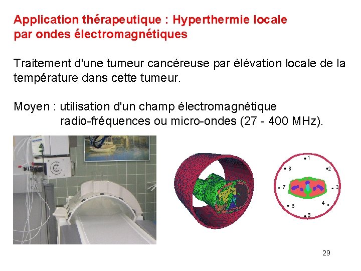 Application thérapeutique : Hyperthermie locale par ondes électromagnétiques Traitement d'une tumeur cancéreuse par élévation