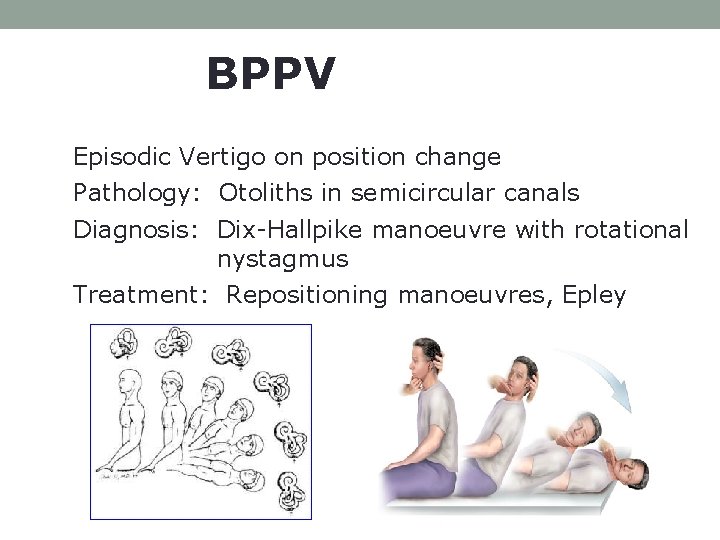 BPPV Episodic Vertigo on position change Pathology: Otoliths in semicircular canals Diagnosis: Dix-Hallpike manoeuvre