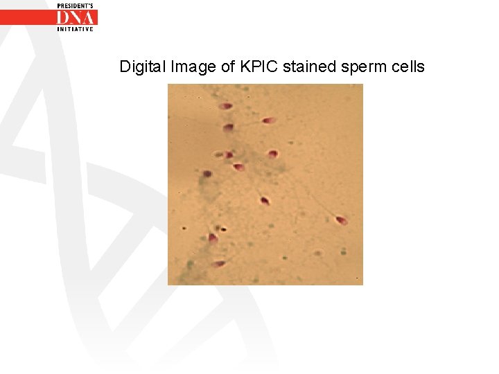 Digital Image of KPIC stained sperm cells 
