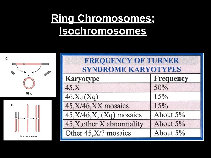 Ring Chromosomes; Isochromosomes 