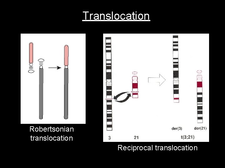 Translocation Robertsonian translocation Reciprocal translocation 