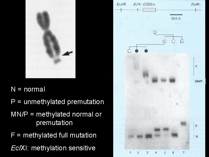 MN/P N = normal P = unmethylated premutation MN/P = methylated normal or premutation