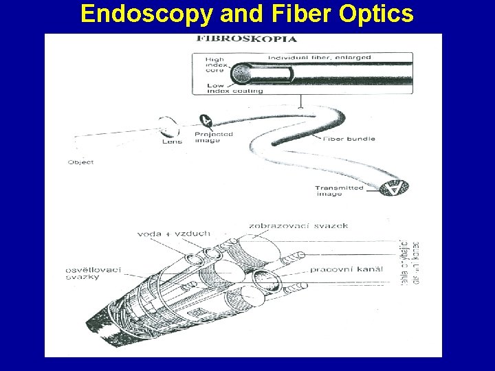 Endoscopy and Fiber Optics 