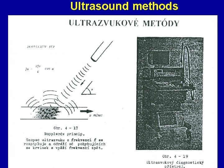 Ultrasound methods 