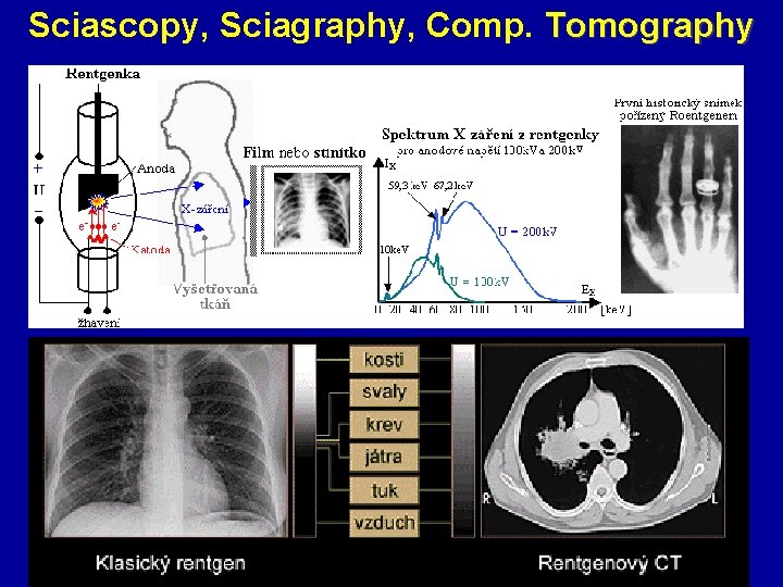 Sciascopy, Sciagraphy, Comp. Tomography 