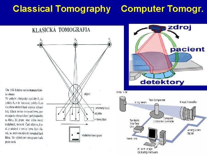 Classical Tomography Computer Tomogr. 