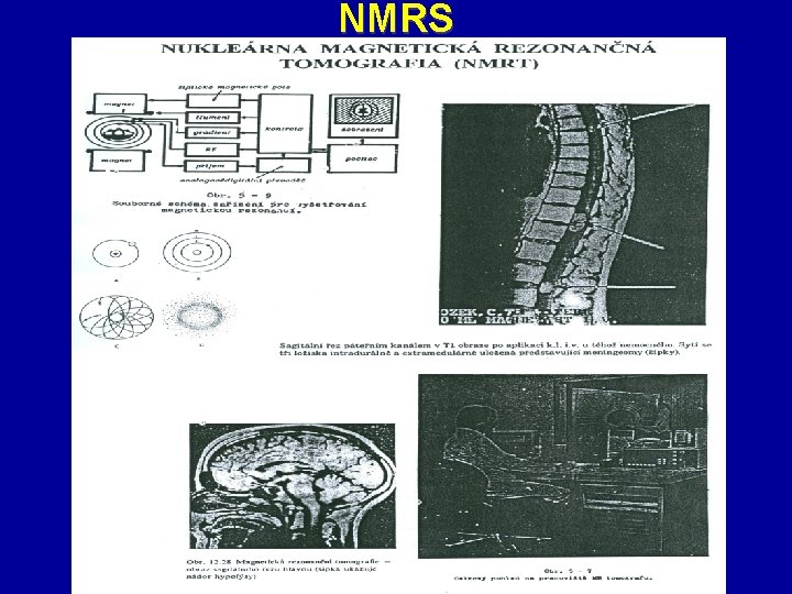 NMRS 