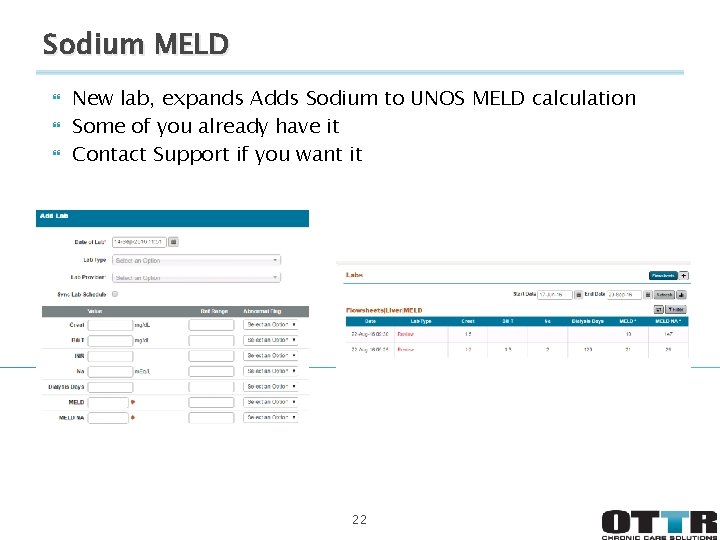 Sodium MELD New lab, expands Adds Sodium to UNOS MELD calculation Some of you