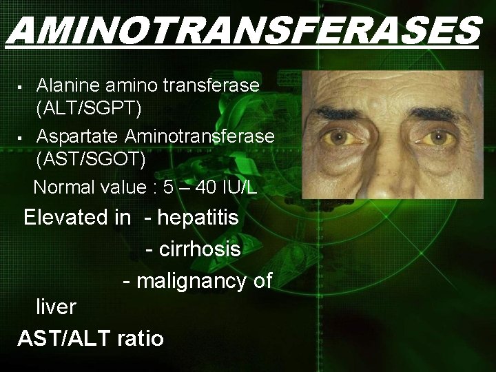AMINOTRANSFERASES § § Alanine amino transferase (ALT/SGPT) Aspartate Aminotransferase (AST/SGOT) Normal value : 5