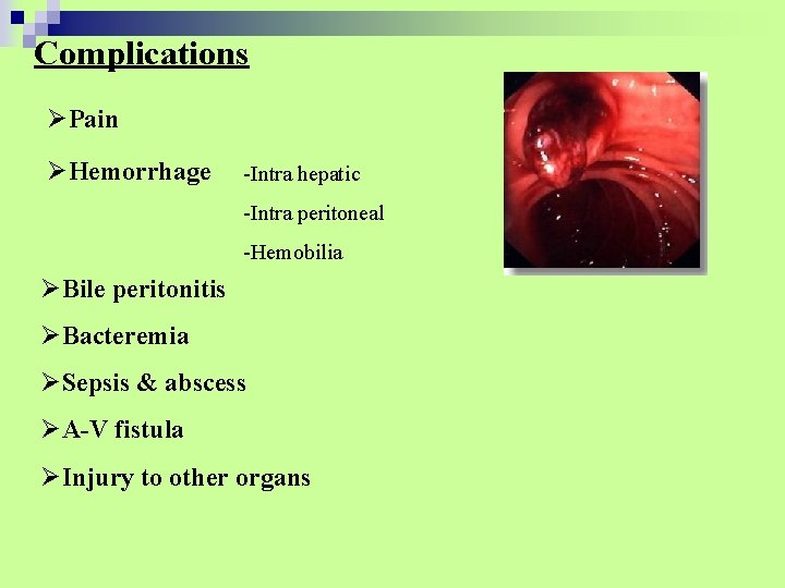 Complications ØPain ØHemorrhage -Intra hepatic -Intra peritoneal -Hemobilia ØBile peritonitis ØBacteremia ØSepsis & abscess