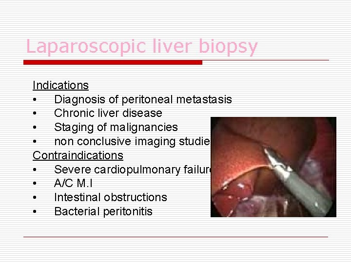 Laparoscopic liver biopsy Indications • Diagnosis of peritoneal metastasis • Chronic liver disease •
