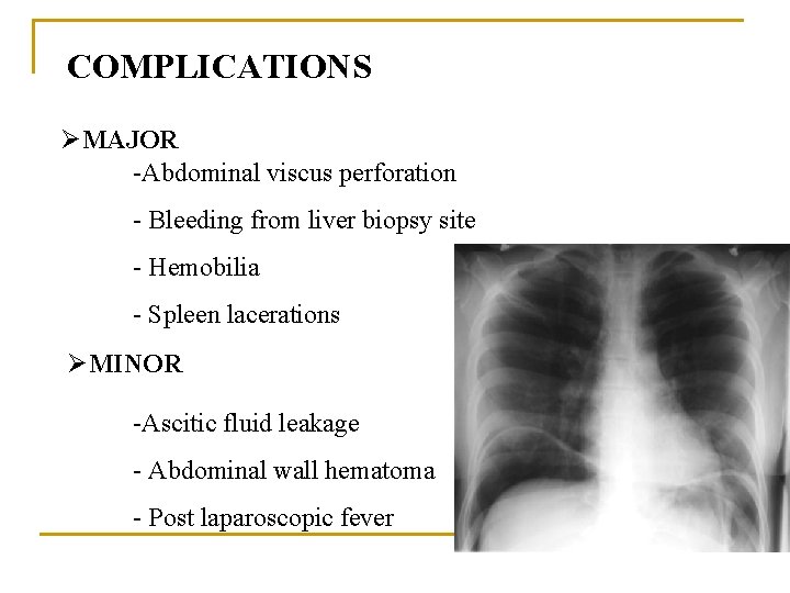 COMPLICATIONS ØMAJOR -Abdominal viscus perforation - Bleeding from liver biopsy site - Hemobilia -