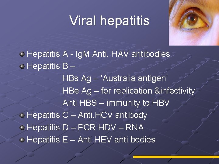 Viral hepatitis Hepatitis A - Ig. M Anti. HAV antibodies Hepatitis B – HBs