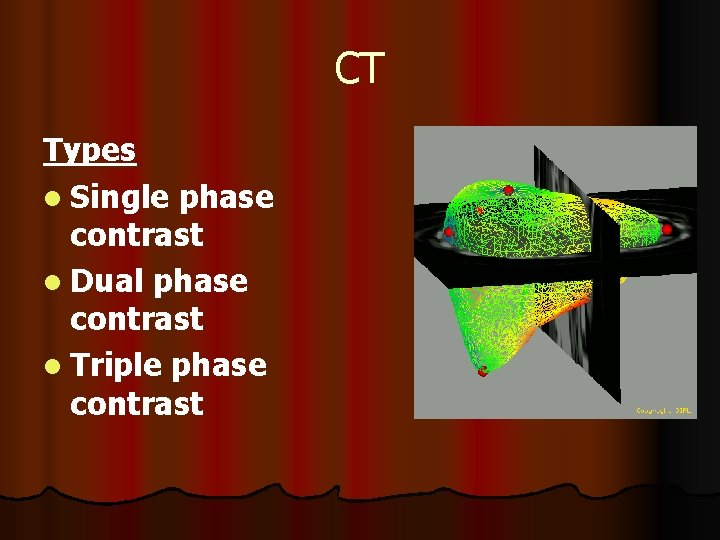 CT Types l Single phase contrast l Dual phase contrast l Triple phase contrast