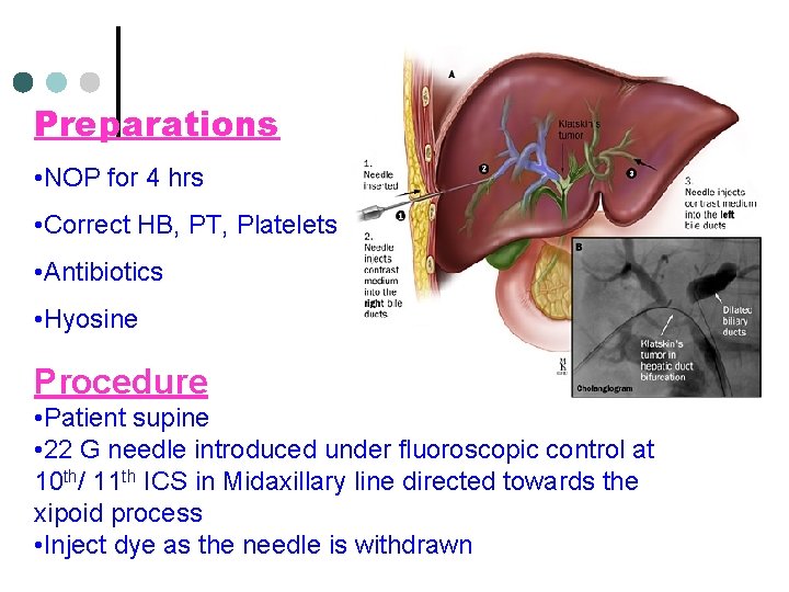Preparations • NOP for 4 hrs • Correct HB, PT, Platelets • Antibiotics •