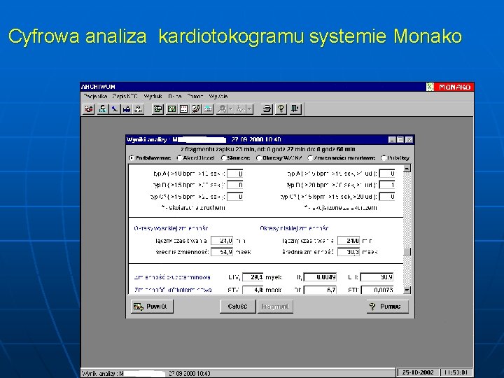 Cyfrowa analiza kardiotokogramu systemie Monako 