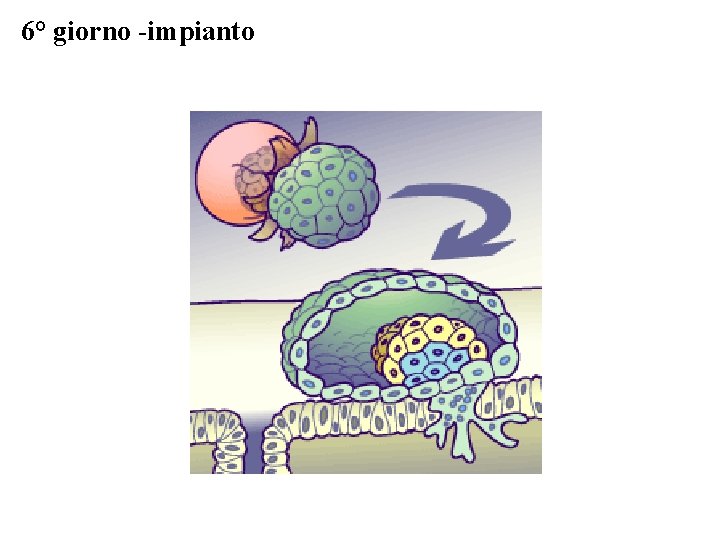 6° giorno -impianto 