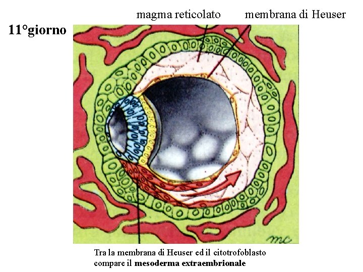 magma reticolato membrana di Heuser 11°giorno Tra la membrana di Heuser ed il citotrofoblasto