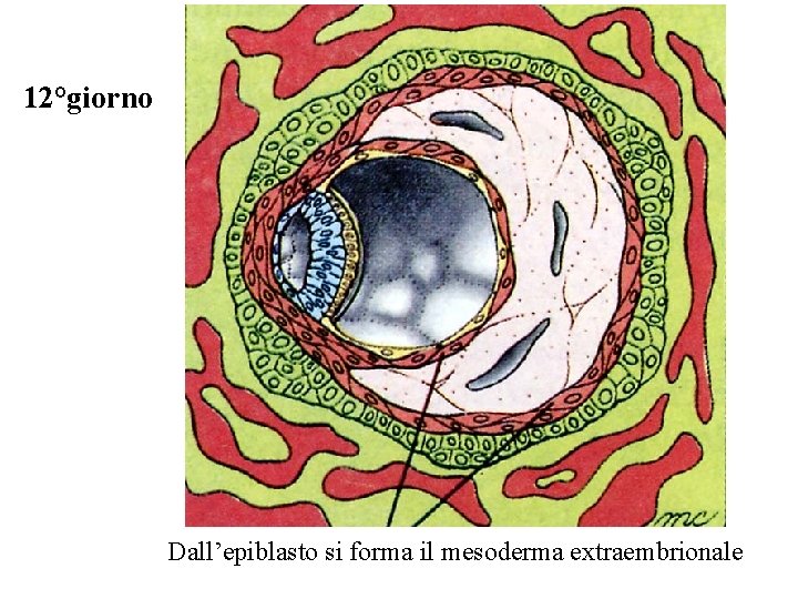 12°giorno Dall’epiblasto si forma il mesoderma extraembrionale 