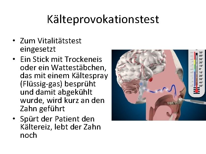 Kälteprovokationstest • Zum Vitalitätstest eingesetzt • Ein Stick mit Trockeneis oder ein Wattestäbchen, das