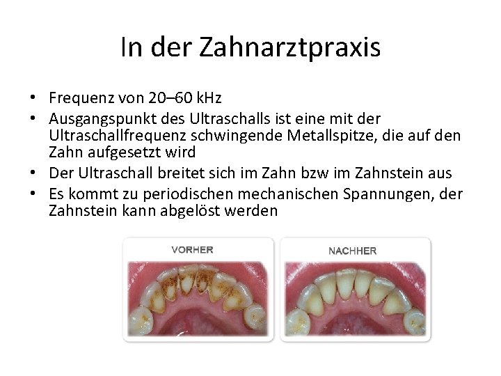 In der Zahnarztpraxis • Frequenz von 20– 60 k. Hz • Ausgangspunkt des Ultraschalls